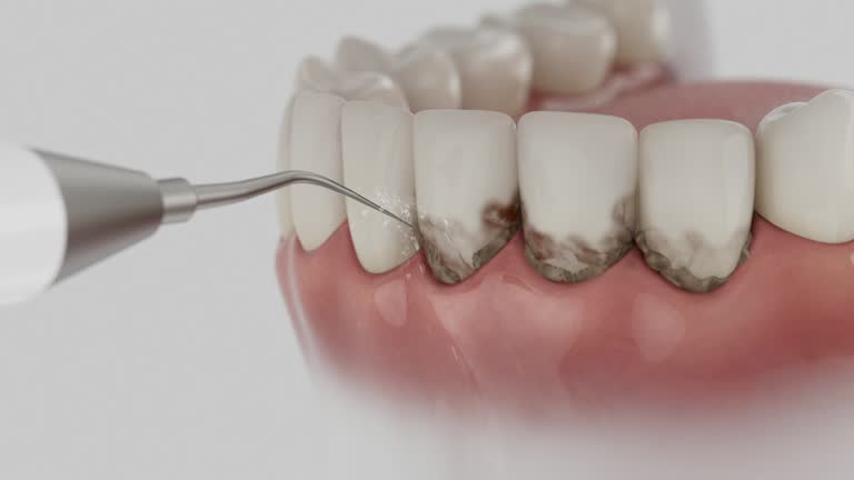 Trusted Root Canal Treatment service in Forest Heights, TX - Dentist Open Now